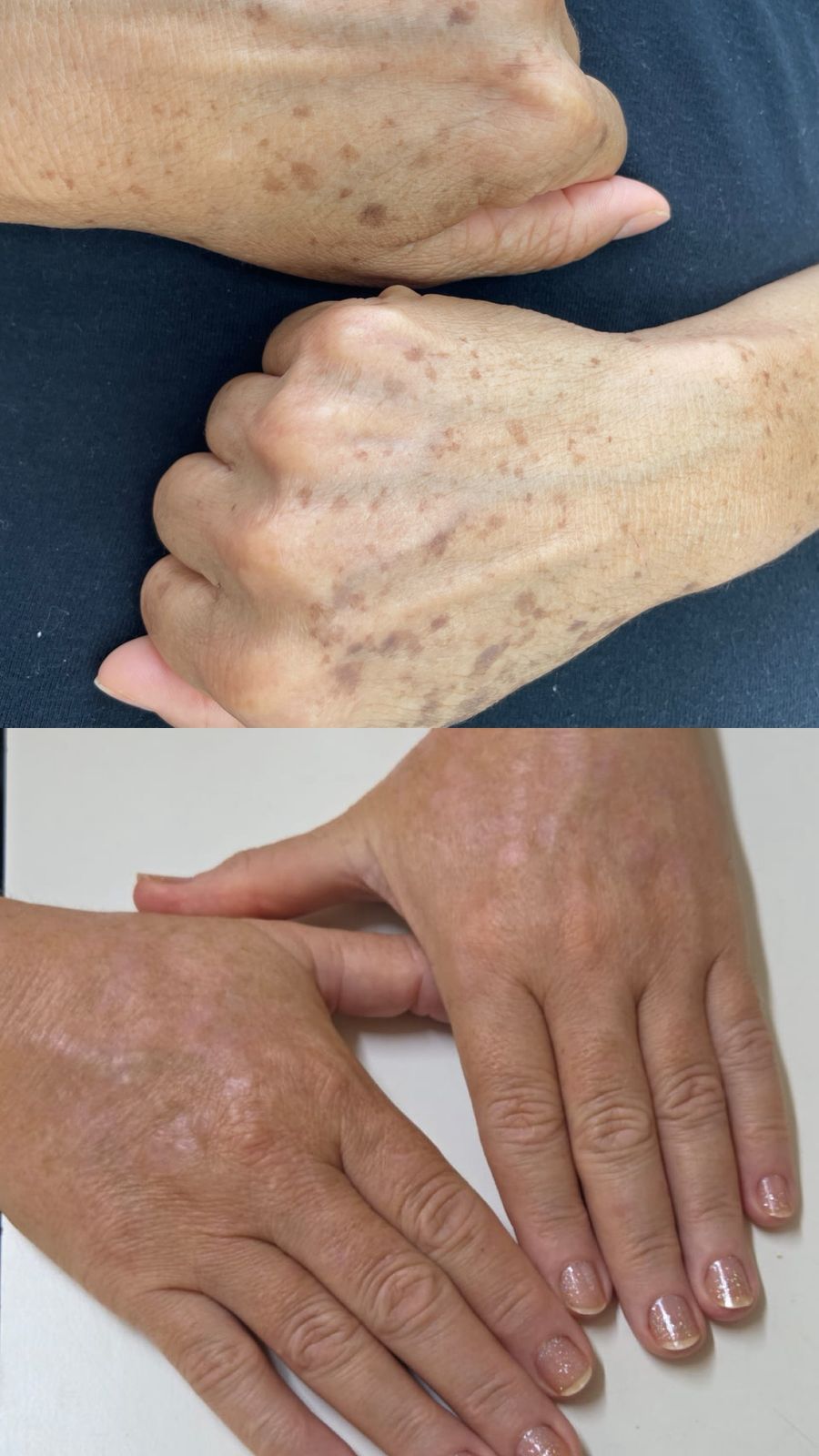 Antes e depois 1