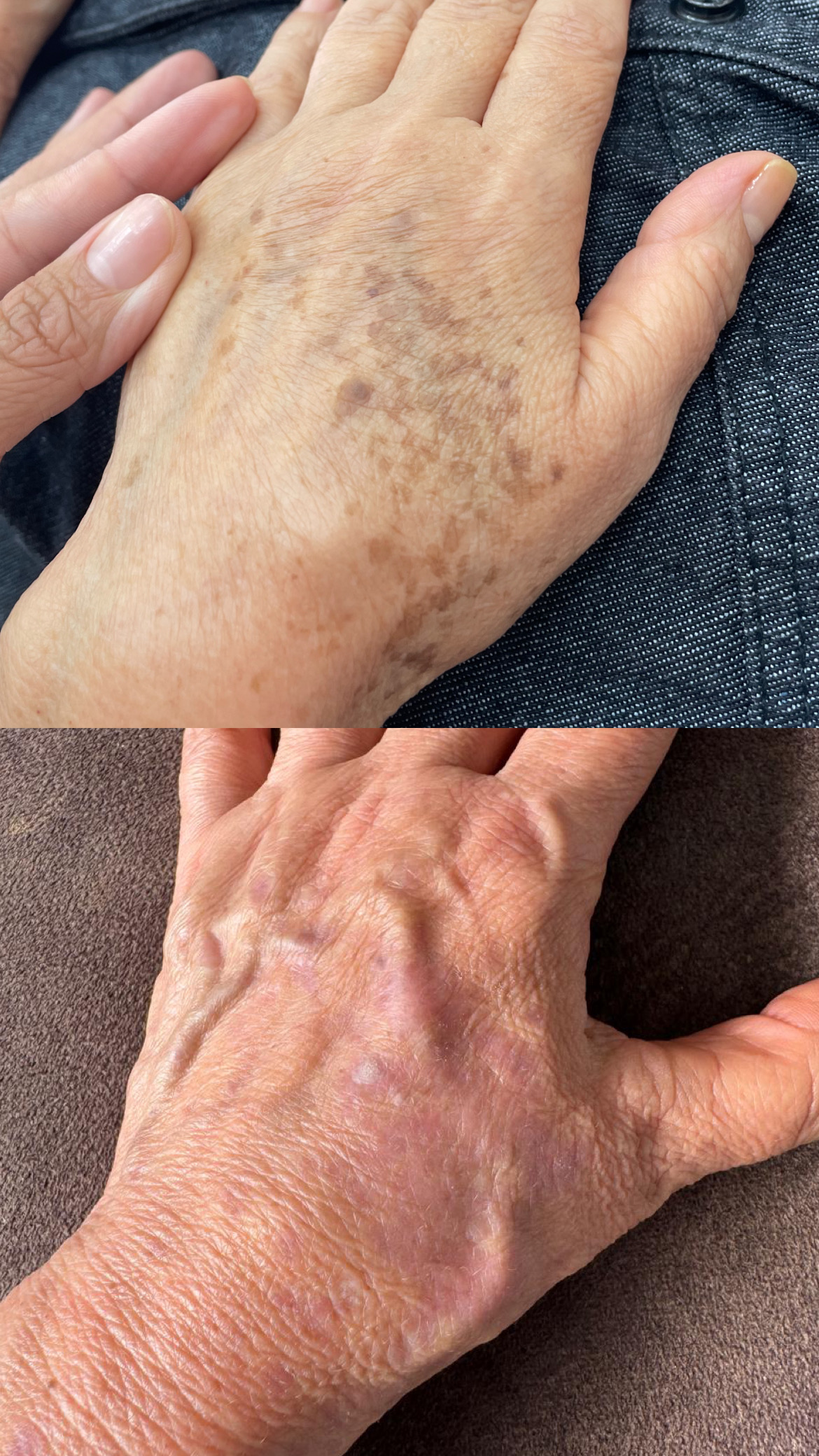 Antes e depois 2