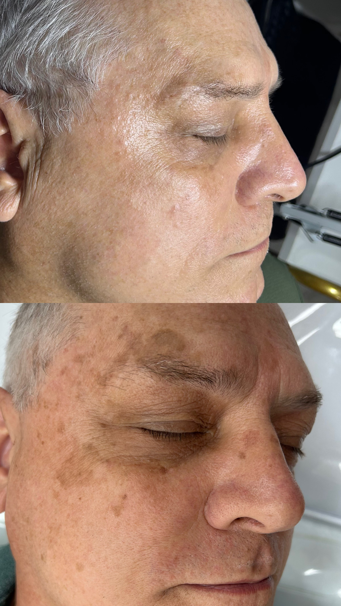 Antes e depois 3