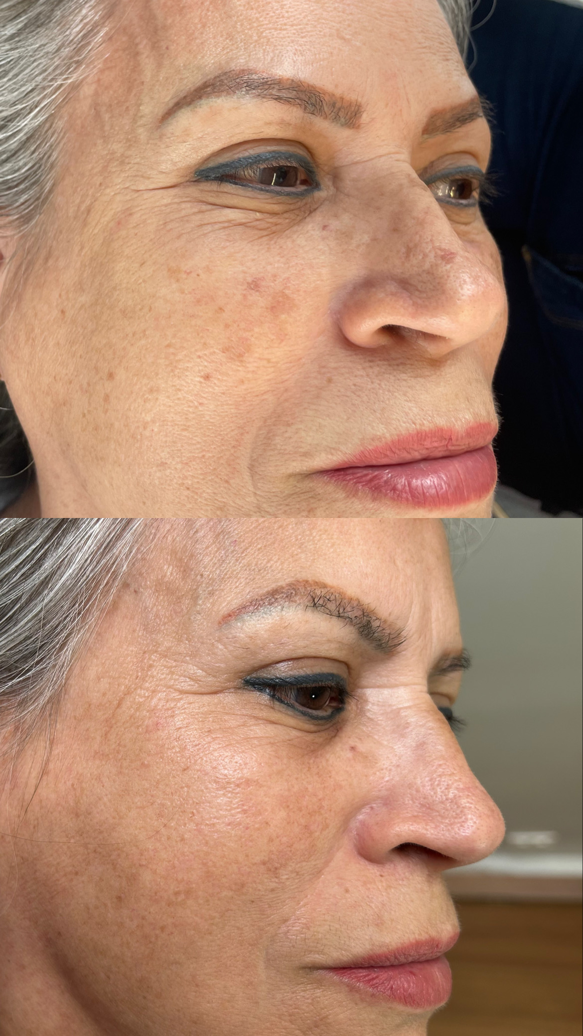 Antes e depois 4